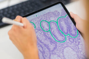 iPad Patologia Digital