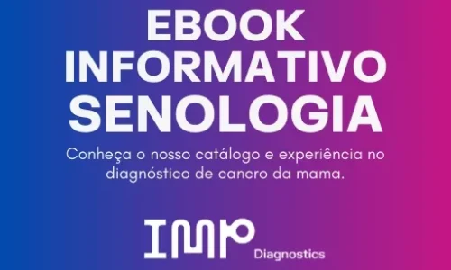 Cancro da Mama