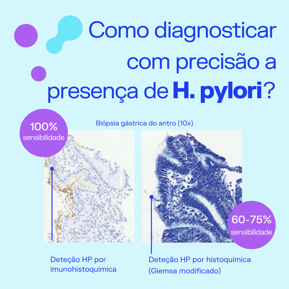 O Que é o Helicobacter Pylori? - IMP Diagnostics