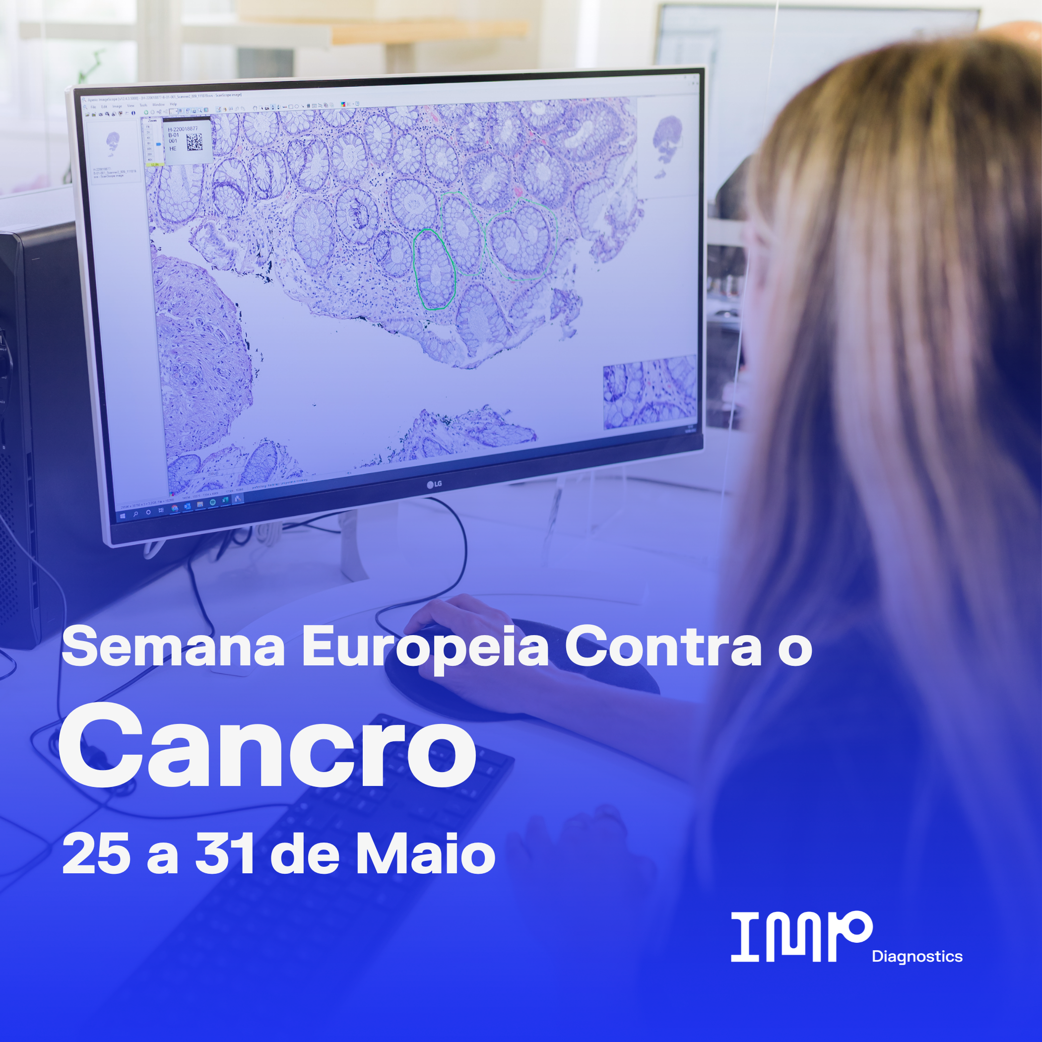  Semana Europeia Contra o Cancro | 25 a 31 de Maio de 2025