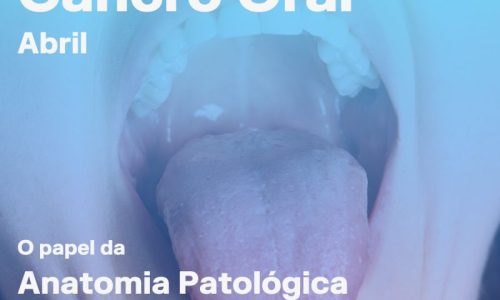 Abril é o mês da Consciencialização do Cancro Oral